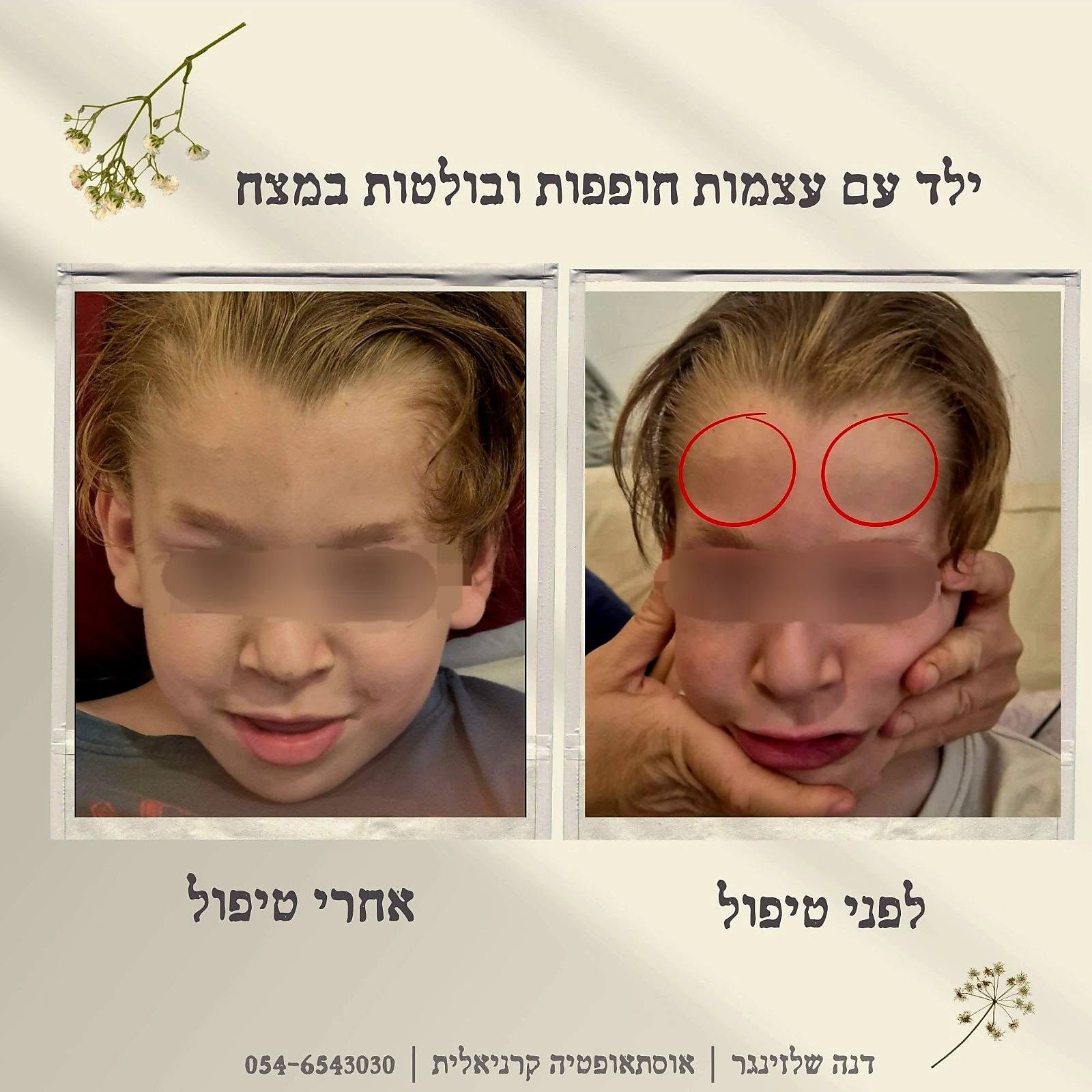 ילד עם עצמות חופפות - מכוסה